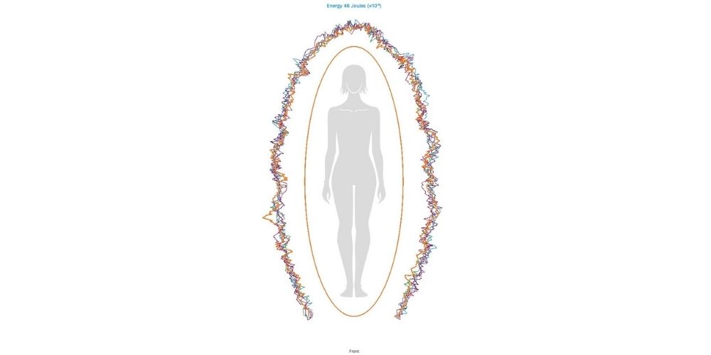 Your Body Is Electric